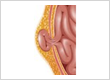 Dr. Shomaf Nakhjo - Advanced Minimally Invasive Surgery