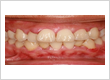 Dental Implants Brownsville