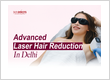 laser hair treatment