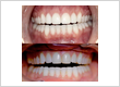 Top-quality Dental Care Toronto