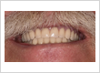 Huntline Dental Group
