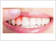Dental Implants Brownsville