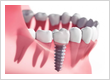 family dentistry