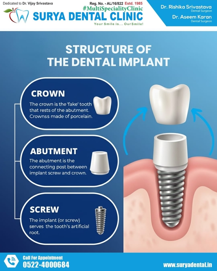 Complete Guide to Choosing the Right Dental Care: Best Tooth Cleaning, Crowns & Bridges, Root Canals, Implants & Cosmetic Dentistry in Lucknow