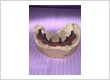 TEETHW~1