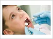 Foods and Habits That Can Interfere with Dental Implant Healing