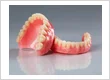 How Much Do Dentures Cost?
