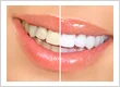 103293 - Genasci & Stigers Family Dental Care
