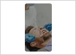 Cosmetic Veneers
