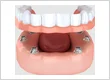 EMG Dentist