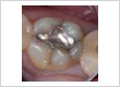 Emergency Dental Care