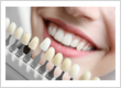 Teeth Straightening in San Diego