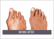 NYC Foot Specialists