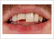 Dental implants provider