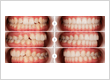Smiling Teeth