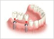 Jeff Montgomery DDS Dentist Huntington Beach