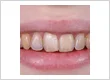 Emergency Dentist
