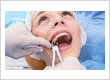 How Often Should Dental Implants Be Professionally Cleaned?