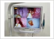 Disimpaction (Surgical removal) of lower wisdom tooth