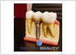Dental Implant Periodontist