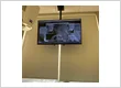 root canal Coppell TX