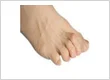 Midtown Podiatrist NYC