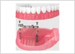 Emergency Tooth Extraction