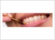 Emergency Tooth Extraction