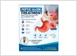 peptic ulcer treatment dr akshay rawat dehradun.jpg