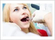 7 Problems That Can Develop from Untreated Wisdom Teeth