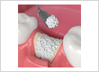 Dental implants provider
