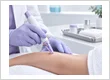 Professional Microneedling
