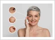 Skinhampshire image1