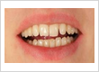 affordable dental implants provider