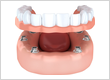 Emergency Dentist