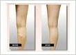 USA Vein Clinics