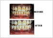 Before and After Treatment