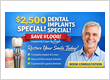 Dental Implants Cypress