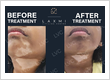 Laxmi vitiligo centre