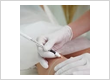 laser hair removal service