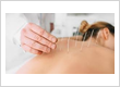 Holistic Acupuncture Therapy Session