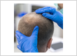 Palm Beach HealthWorks - Plantation | Hair Consultations