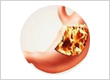 Best Gastroenterologist