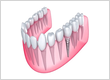 implant dentistry