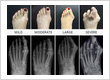 Midtown Podiatrist NYC