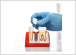 Dental implants periodontist