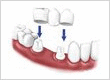 Jeff Montgomery DDS Dentist Huntington Beach